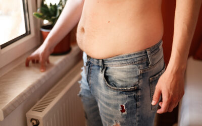 Liposuction for Male Abdomen: The Key to a Flat Stomach in 2025